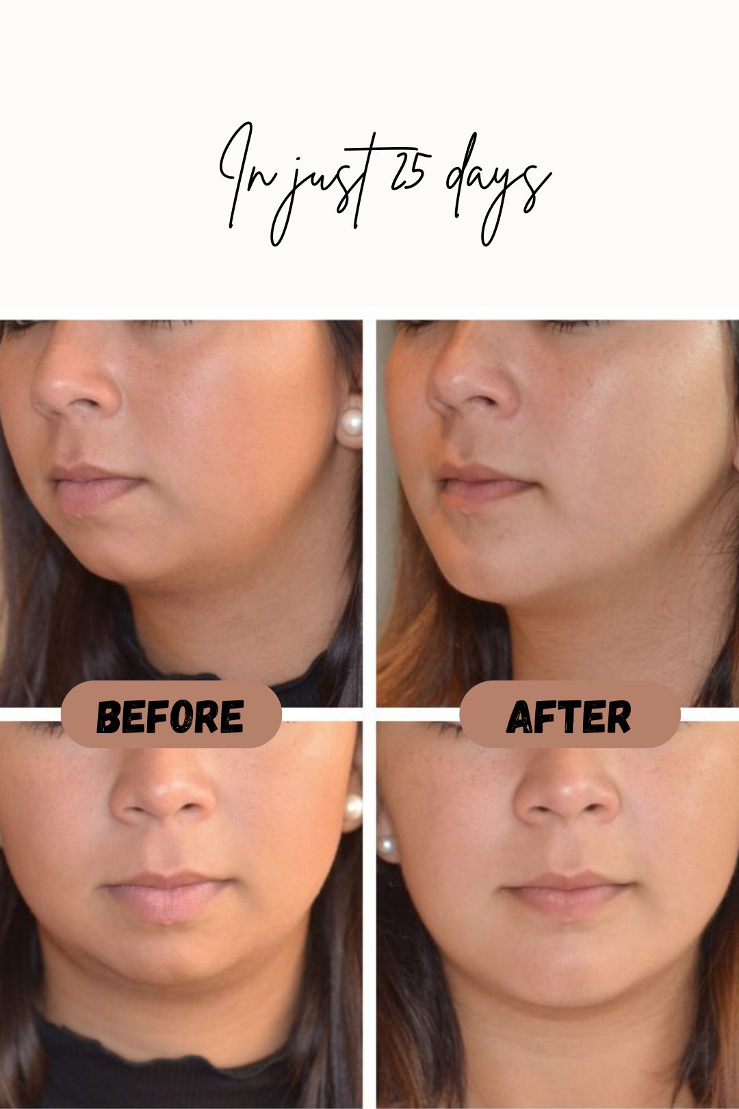 Poppy | Firming Shapewear for a Slimmed Face